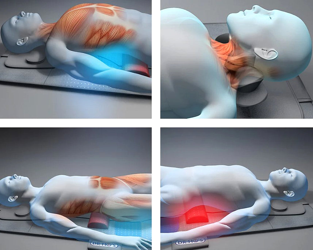 DR-HO’S MotionSolution – gerincnyújtó és mobilizáló matrac 5 